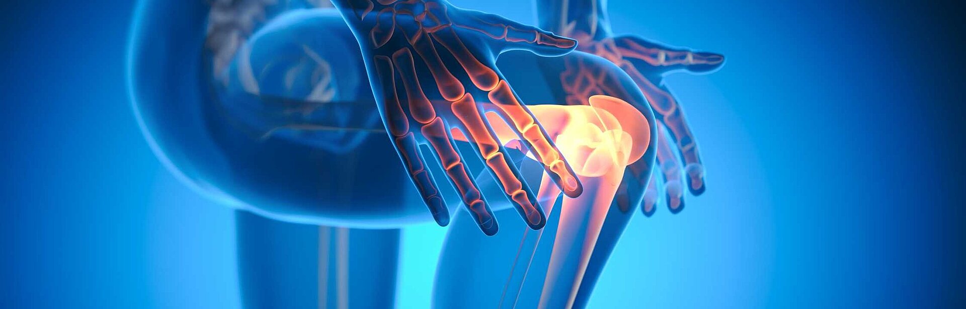 schematische Abbildung von Schmerzen im Kniegelenk | Endo­prothetik­zentrum am Katho­lischen Kranken­haus Erfurt